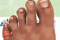 簡単ステップでネイルドクターになろう